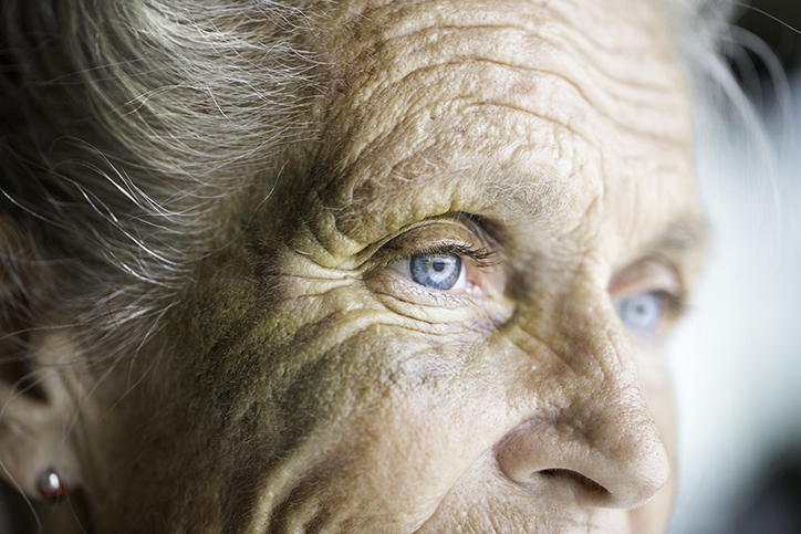 Senior woman with bruises on her skin